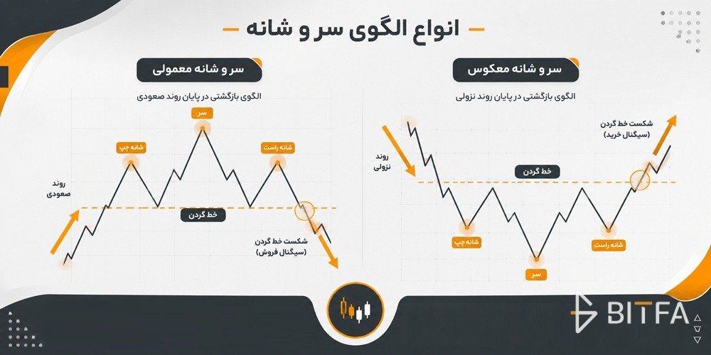 انواع الگوی سر و شانه